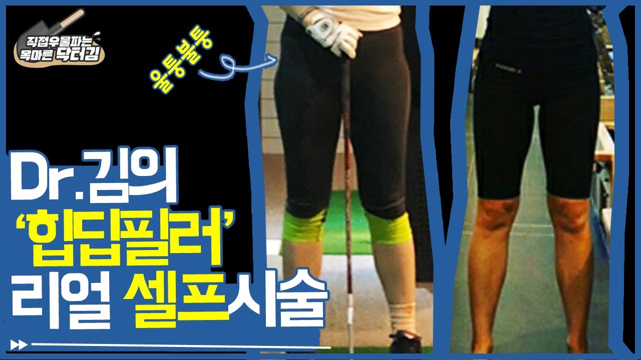 울퉁불퉁한 골반 힙딥(hip-dip)_닥터김의 힙딥필러 리얼 셀프시술