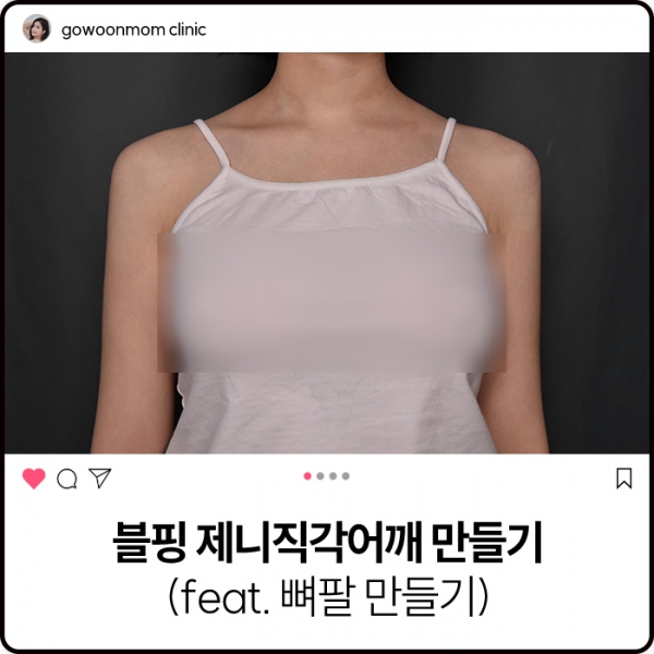 블핑 제니직각어깨 만들기 (feat.뼈팔 만들기)