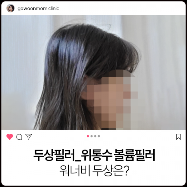 두상필러_콘헤드 정수리필러:워너비 두상은? 나의 원픽 블핑제니! 윗통수도 중요하다!!